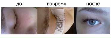 Фотография Просто Дензал
