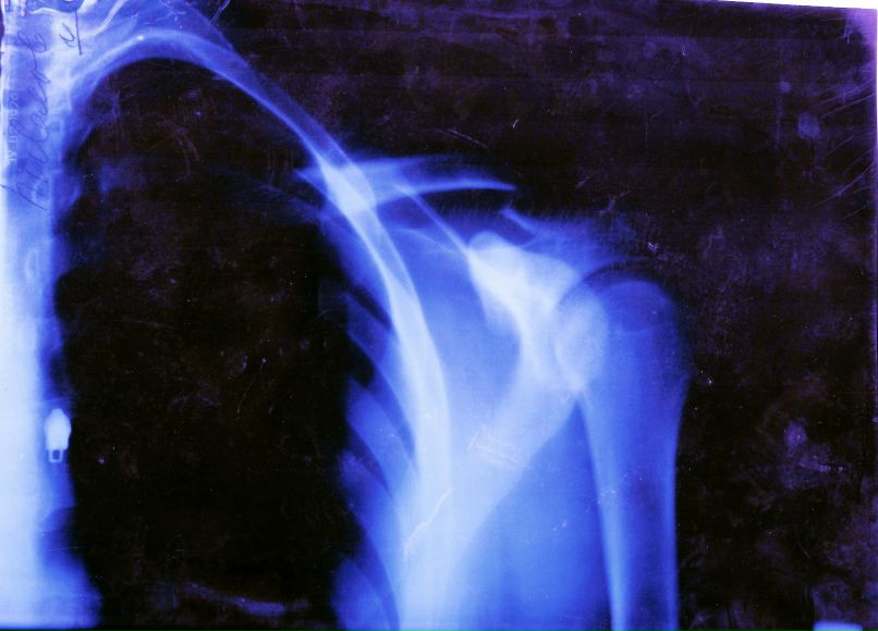 Dam Omen фотография #7