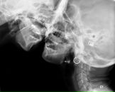 Фотография Заикина Александра